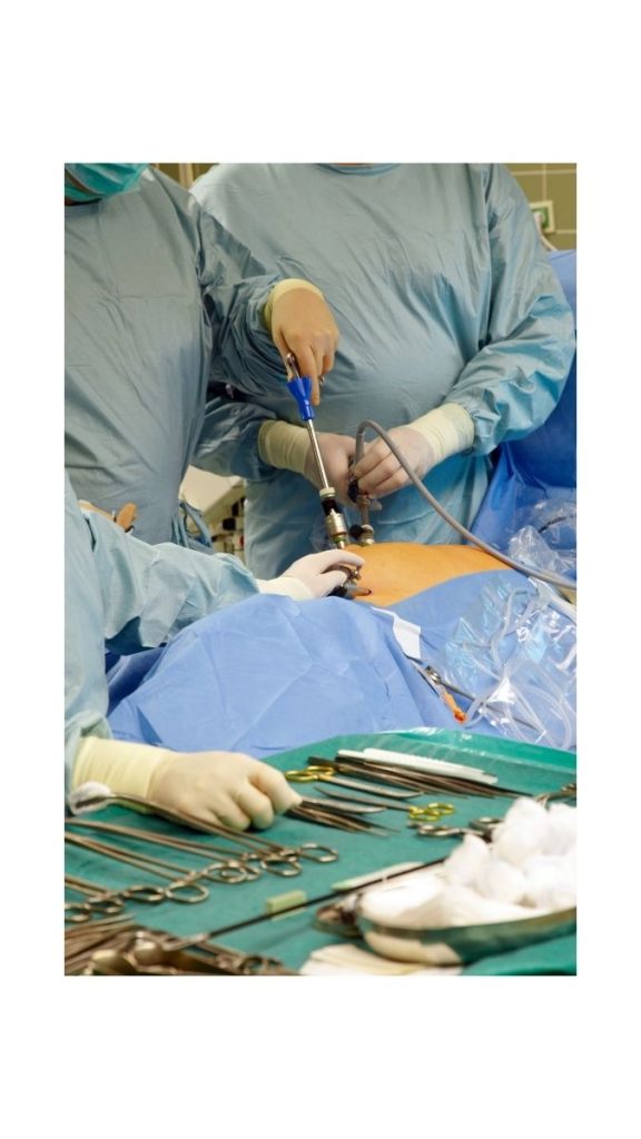 Dióxido de carbono en cirugías laparoscópicas, un gas medicinal esencial para la insuflación abdominal.